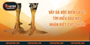 Vảy Gà Độc Biên Là Gì? Tìm Hiểu Dấu Hiệu Nhận Biết Cực Chuẩn
