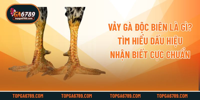 Vảy Gà Độc Biên Là Gì? Tìm Hiểu Dấu Hiệu Nhận Biết Cực Chuẩn
